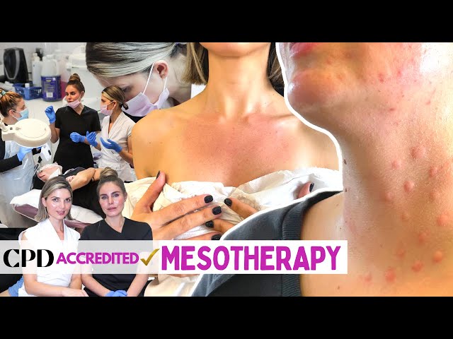 Introduction To Our New Mesotherapy Course | Everything You Need To Know [Microneedling Skin Care]