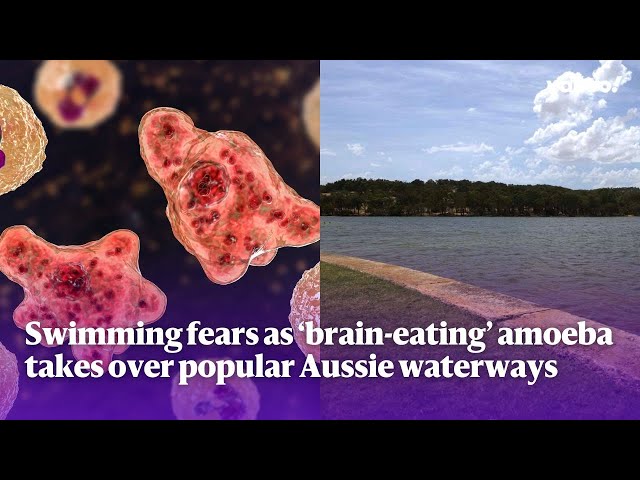 'Brain-eating’ amoeba detected in Aussie waterways: What you need to know | Yahoo Australia