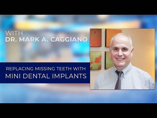 Replacing Missing Teeth with Mini-Dental Implants with Seattle dentist Mark A. Caggiano, DDS